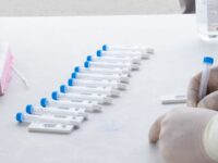 Τεστ ανίχνευσης Covid-19, το 13ο κατά σειρά στο Δήμο Πεντέλης θα διενεργηθεί το Σάββατο 24/7 στην Πλατεία Αγίου Γεωργίου (Μελίσσια) από 08:00 π.μ. έως 13:00 μ.μ.